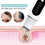 Facial - Ultrasonic Deep Cleaning