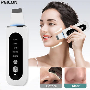 Ultrasonic Deep Face Cleaning